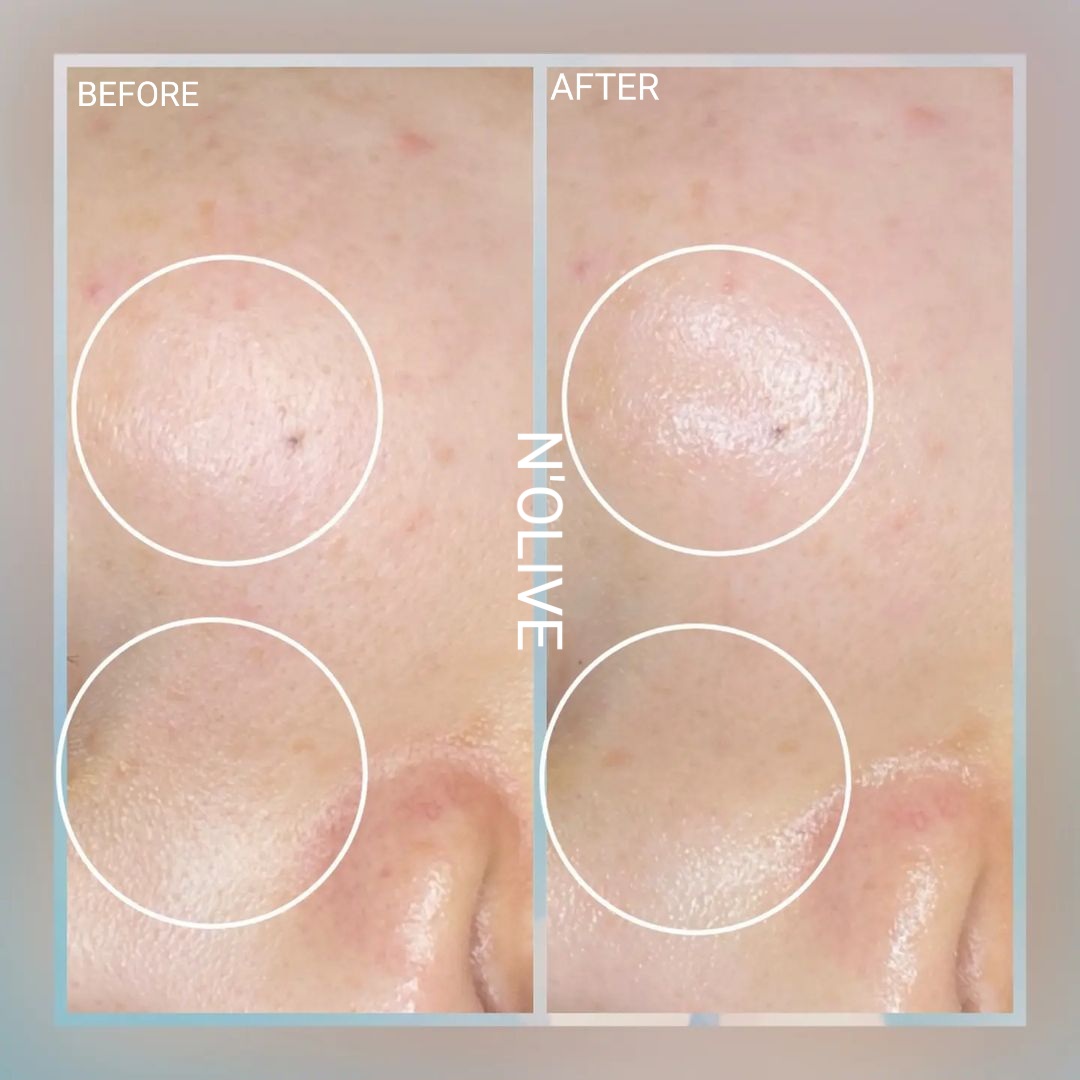 앤올리브에스테틱 대표 이미지