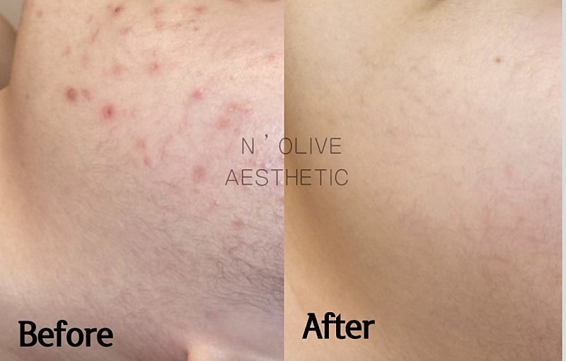 앤올리브에스테틱 대표 이미지