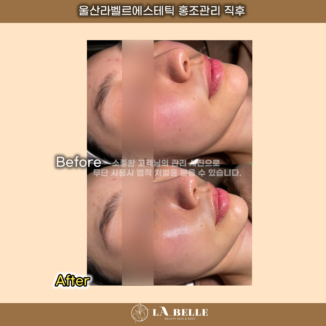 라벨르 에스테틱