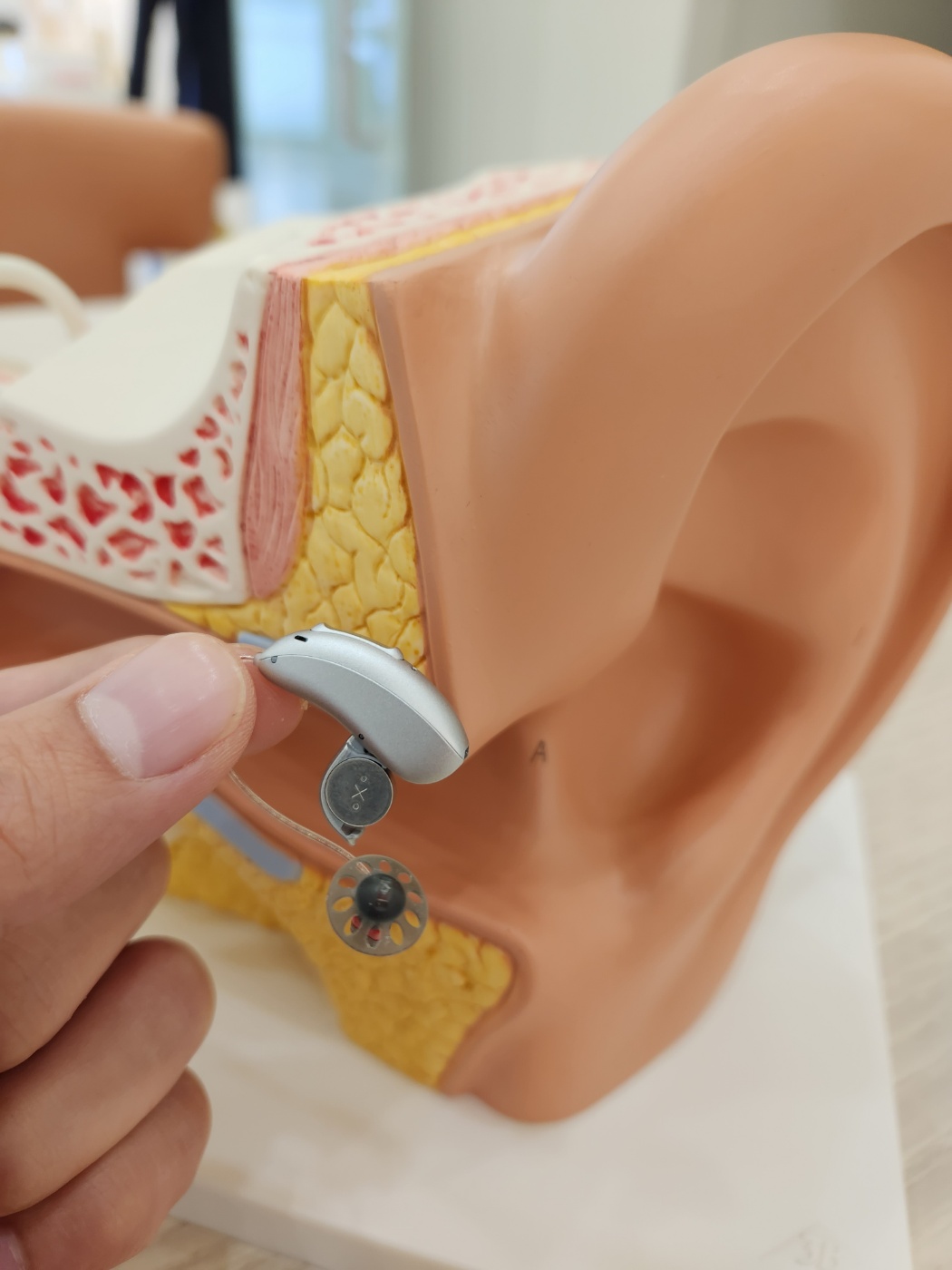 바른 서울보청기 여수센터