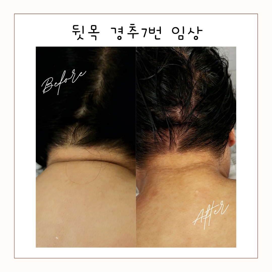 진심테라피 미아점 photo 6