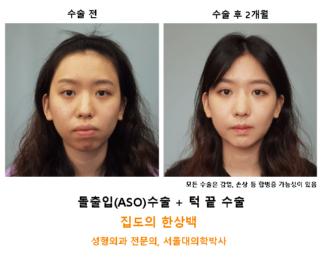 서울제일성형외과 대표 이미지
