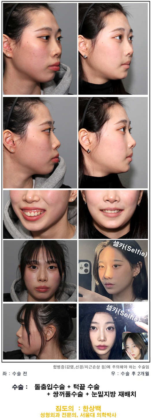 서울제일성형외과 대표 이미지