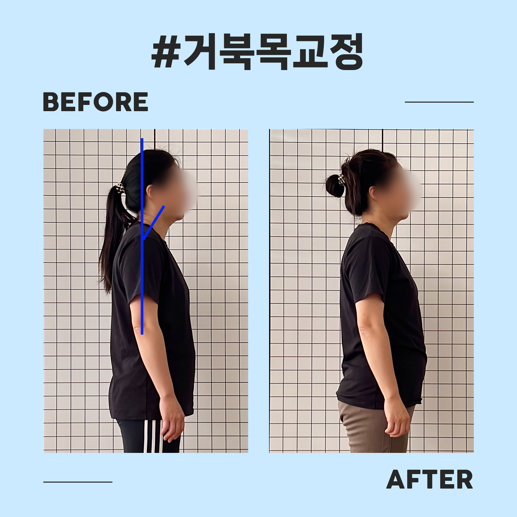 곳피티