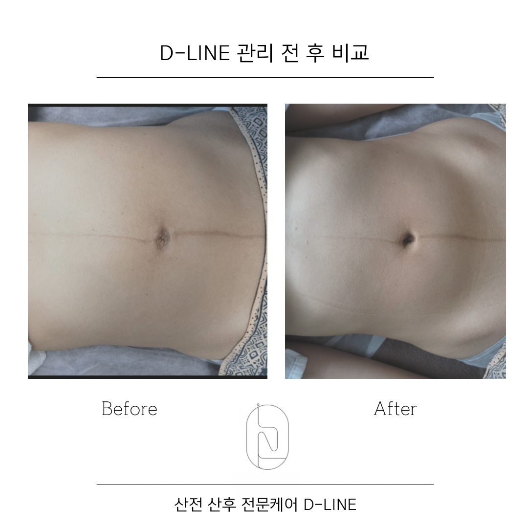 디라인 양산 photo 3