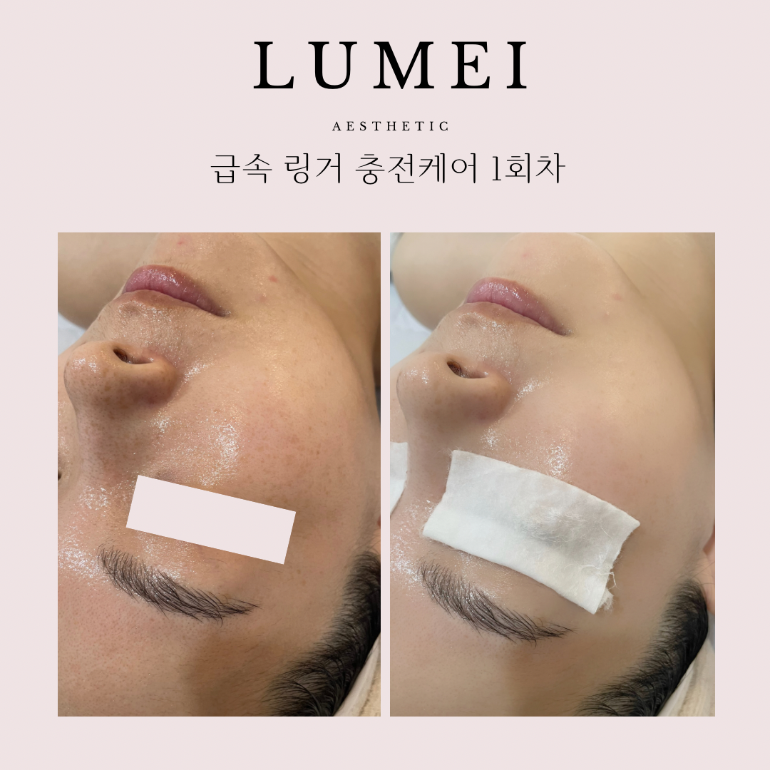 루메이에스테틱