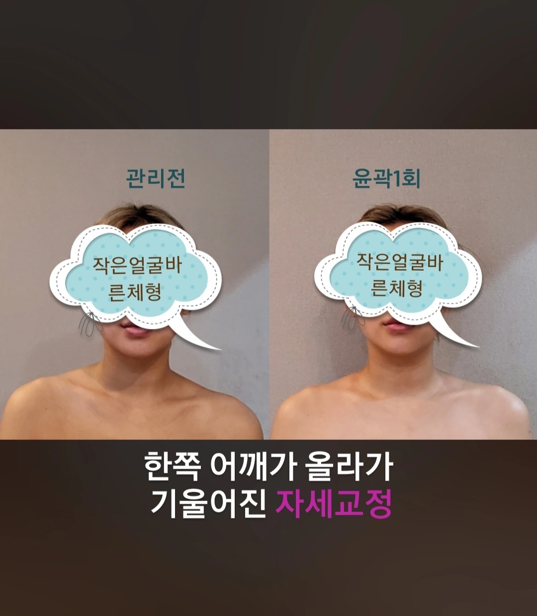 작은얼굴바른체형