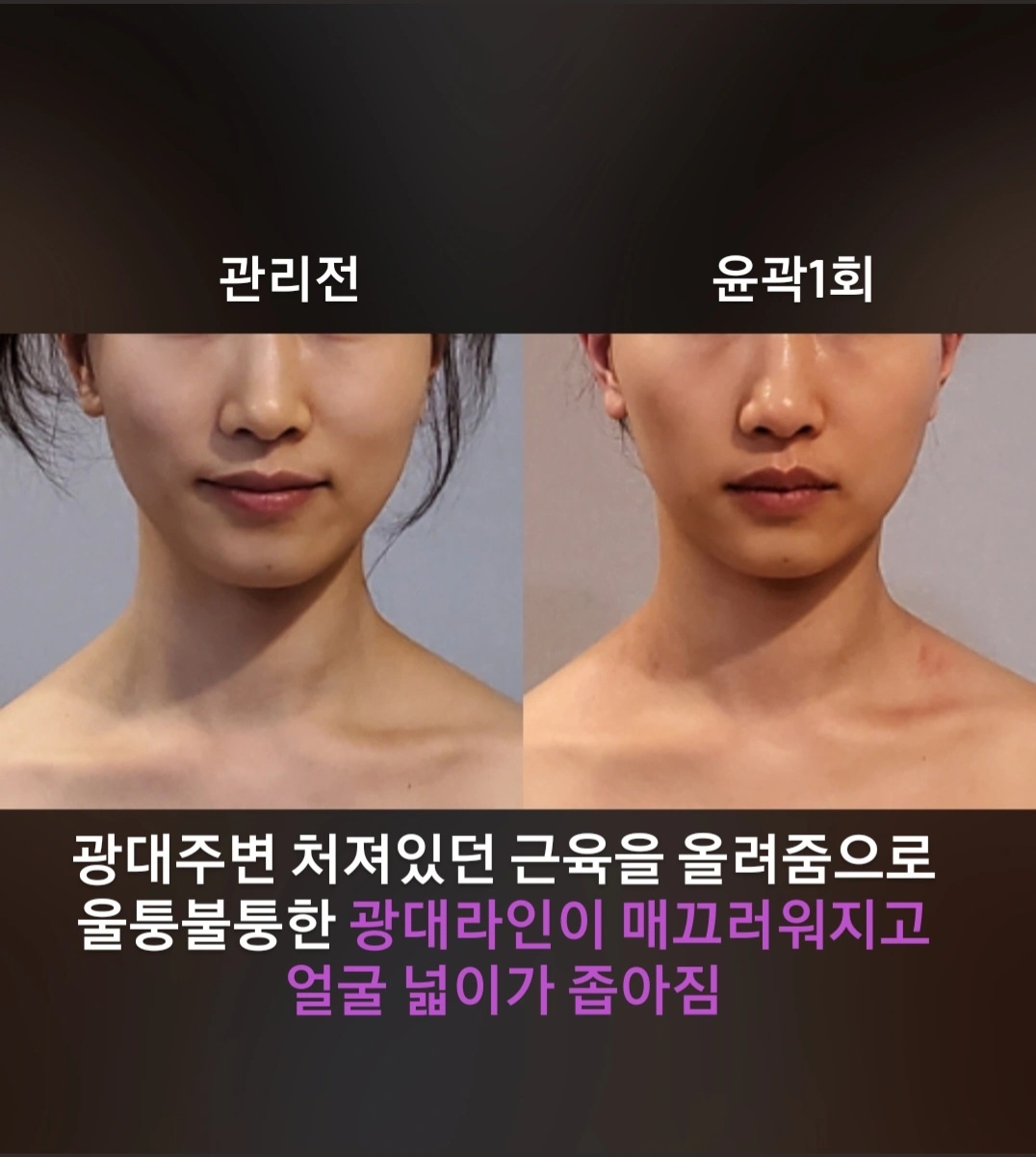 작은얼굴바른체형