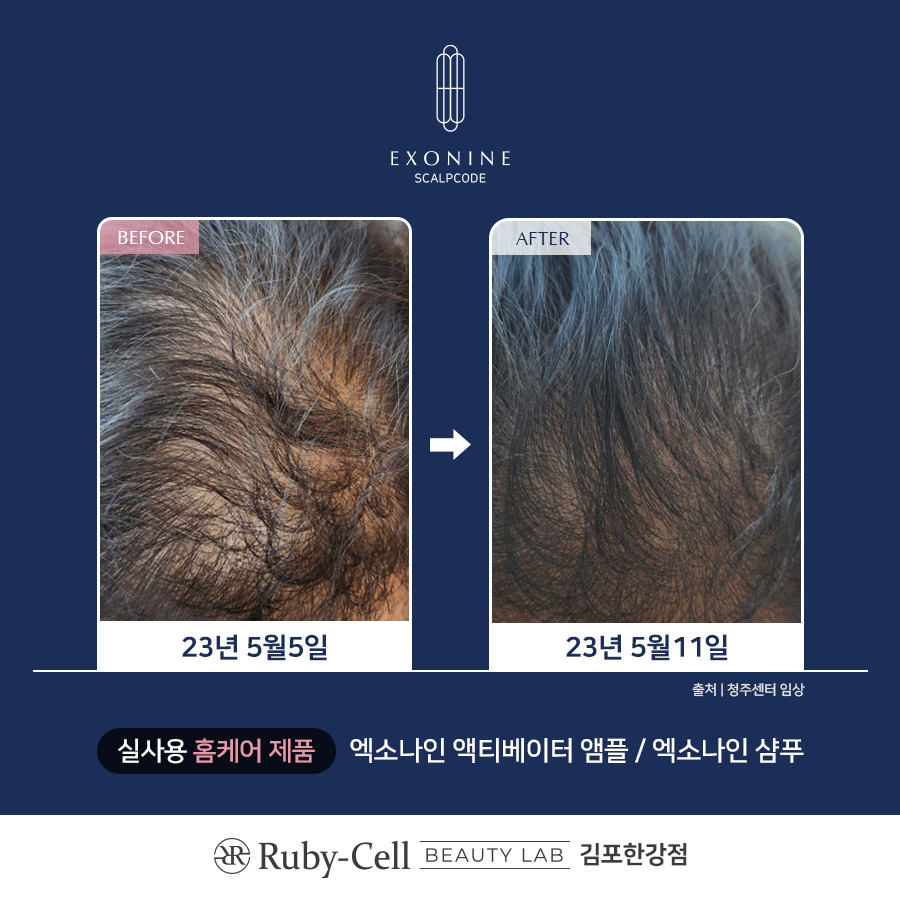 루비셀뷰티랩 김포한강점