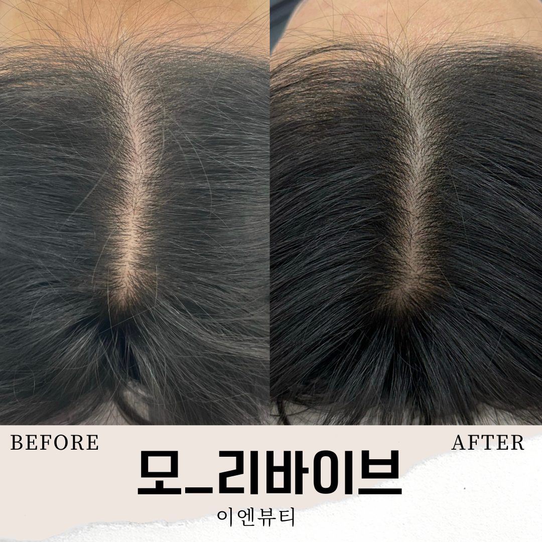 이엔뷰티