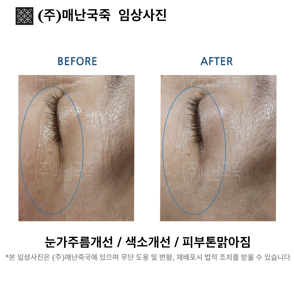 단미스킨앤바디