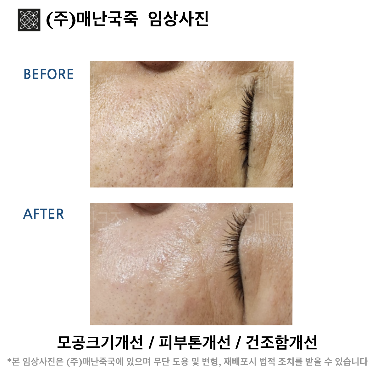 단미스킨앤바디