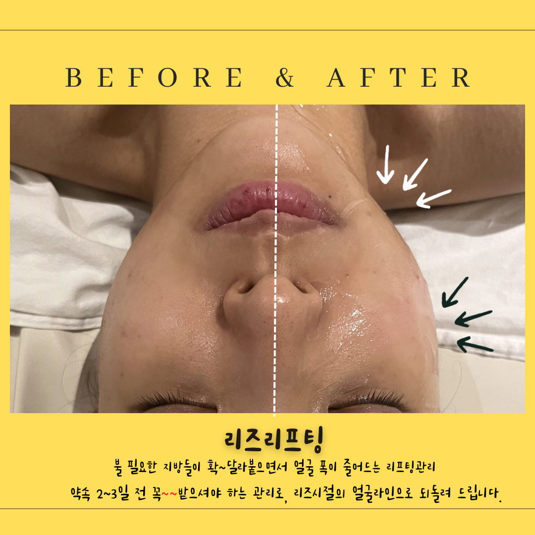 제이메디앤스파 잠실본점