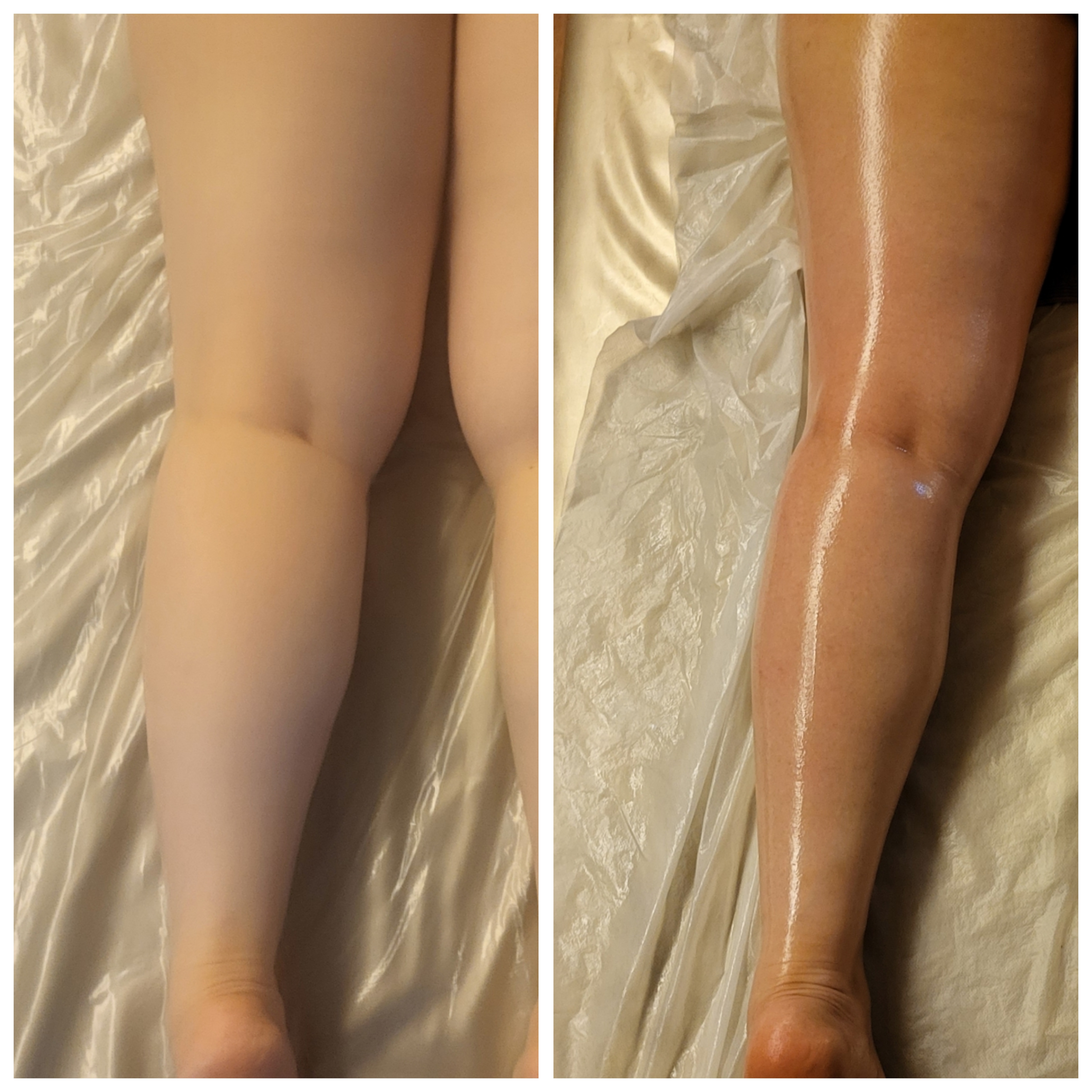 에너지테라피 포유 photo 9