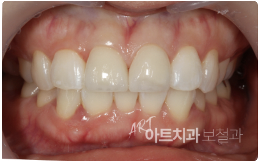 부평아트치과의원 대표 이미지