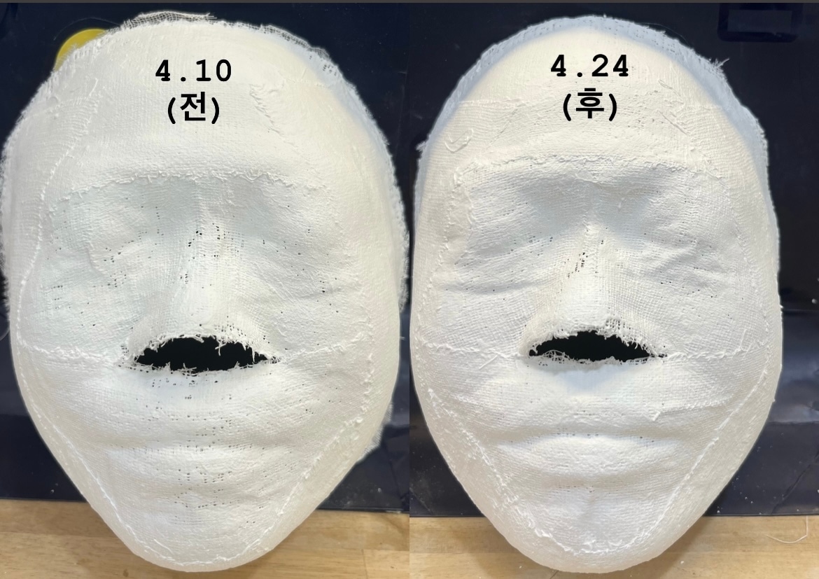 려원 피부관리