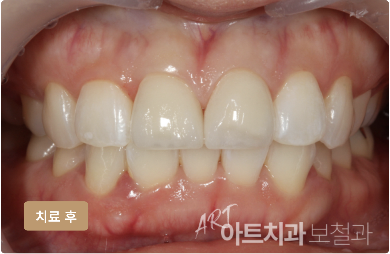 부평아트치과의원 대표 이미지