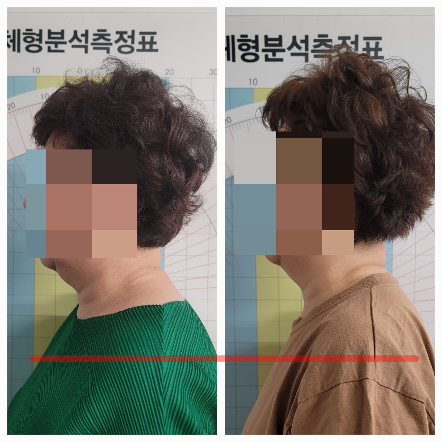 새온뷰티 두골비얼굴축소연구소