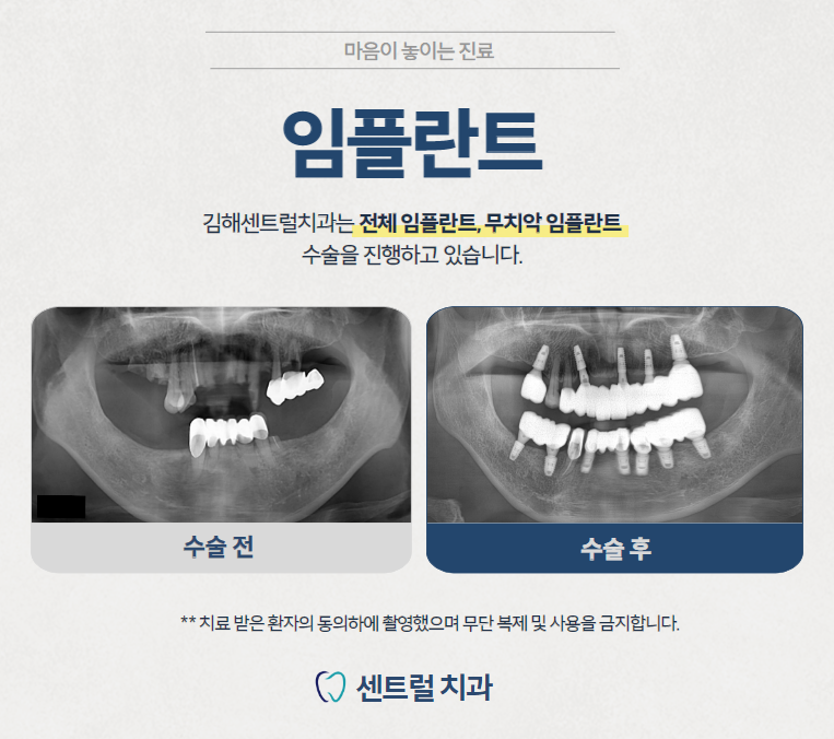 센트럴치과의원 대표 이미지