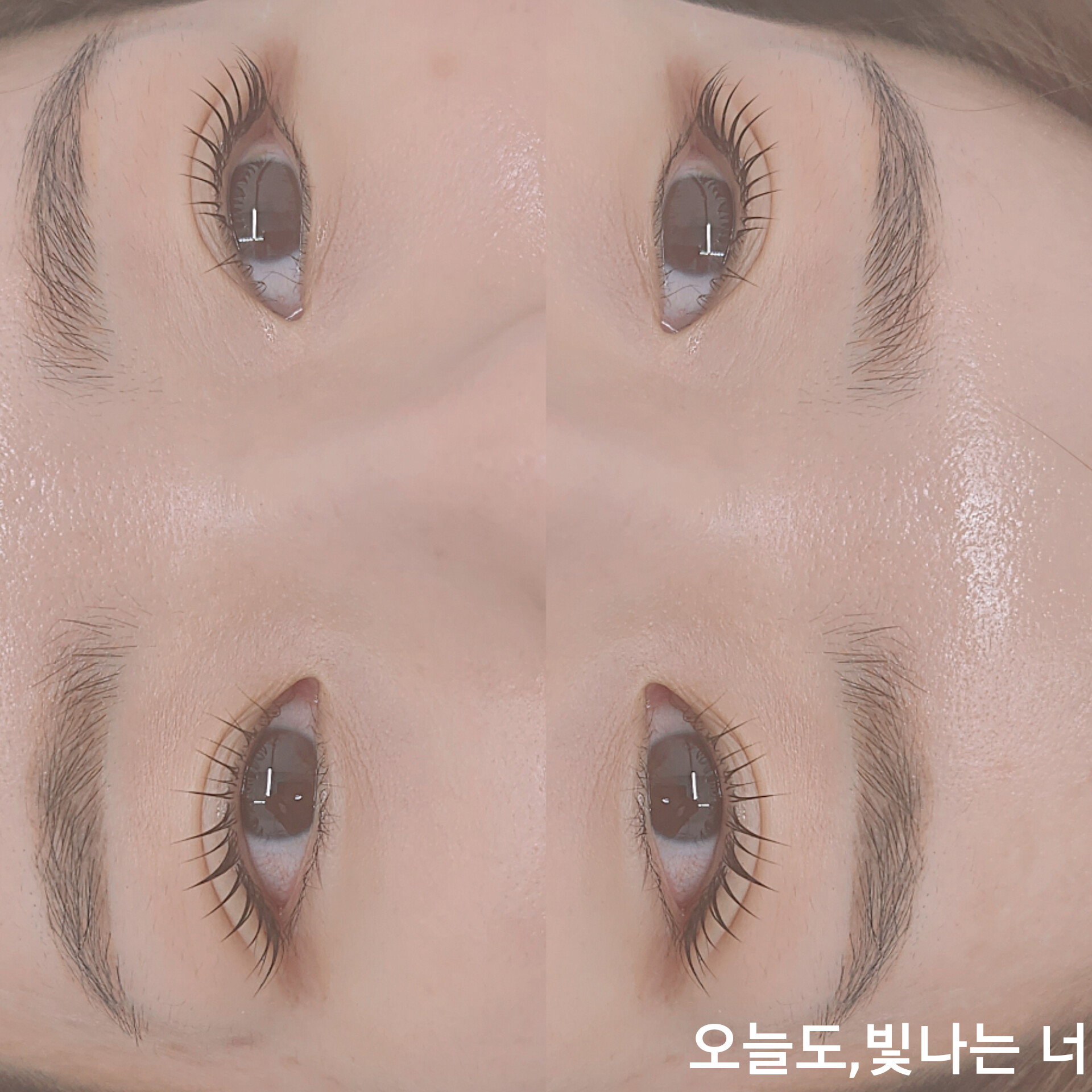 오늘도빛나는너
