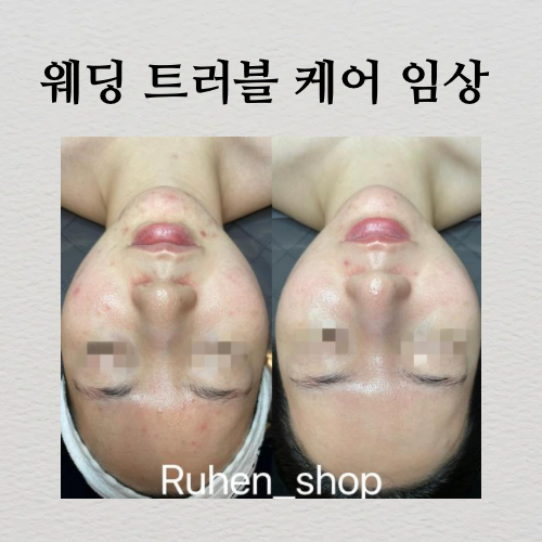 에스테틱 루엔샵
