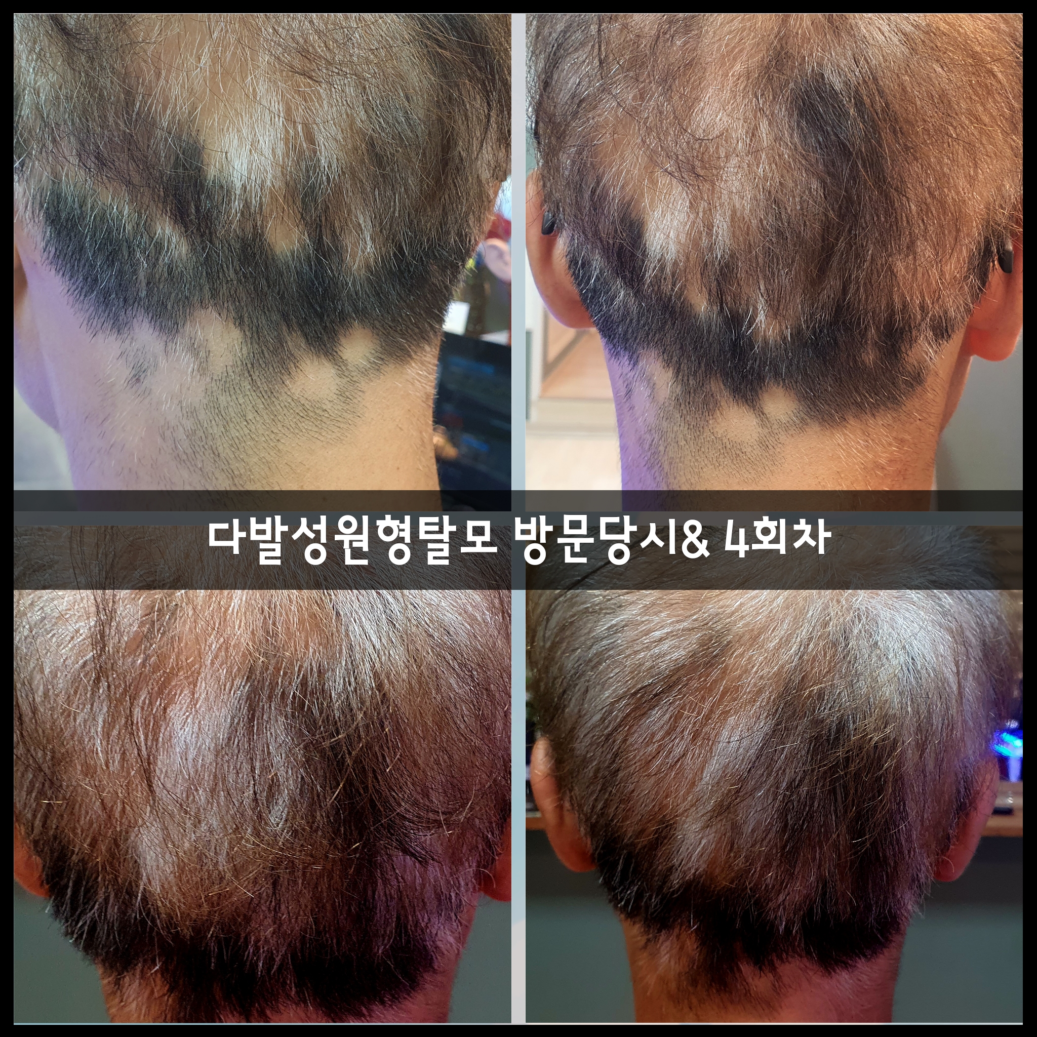 서주은두피센터 대표 이미지
