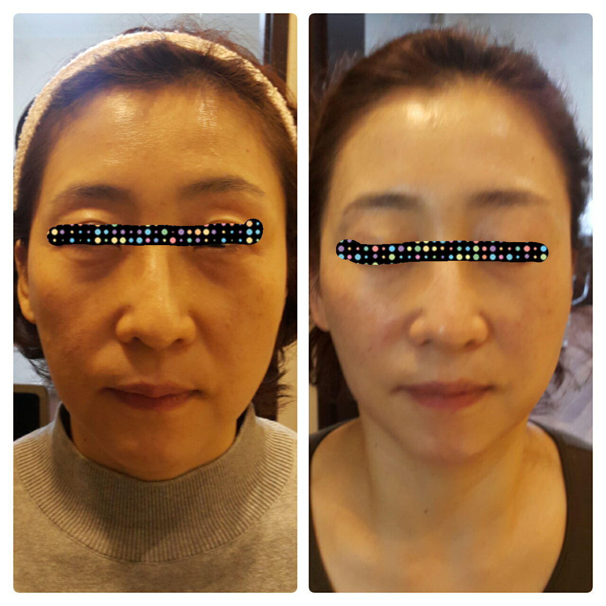 짱박사뷰티 photo 9