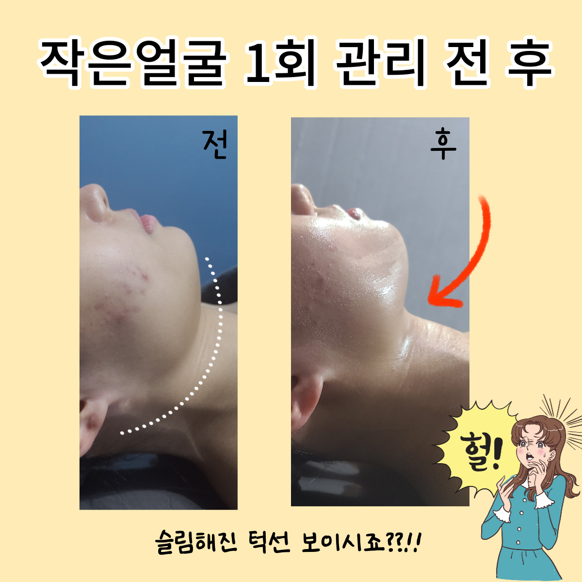 S바디피규어 피부 체형관리 photo 7