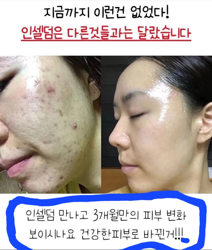 용인성공동안샵