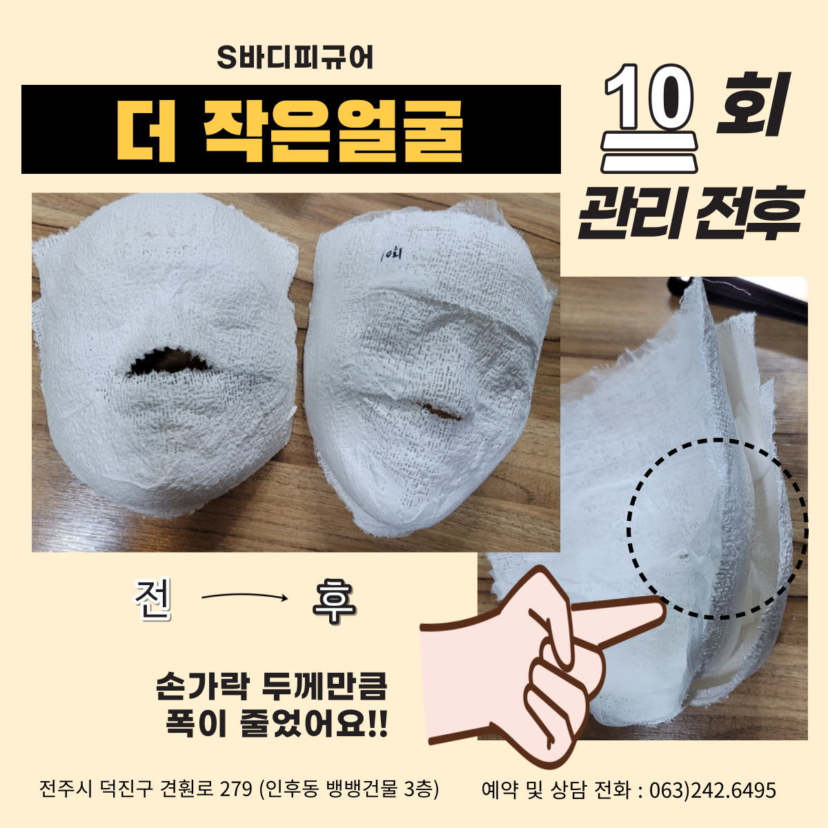 S바디피규어 피부 체형관리 photo 6