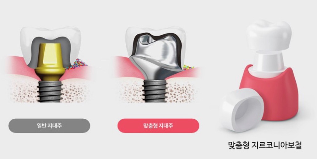 청주1등치과의원 대표 이미지