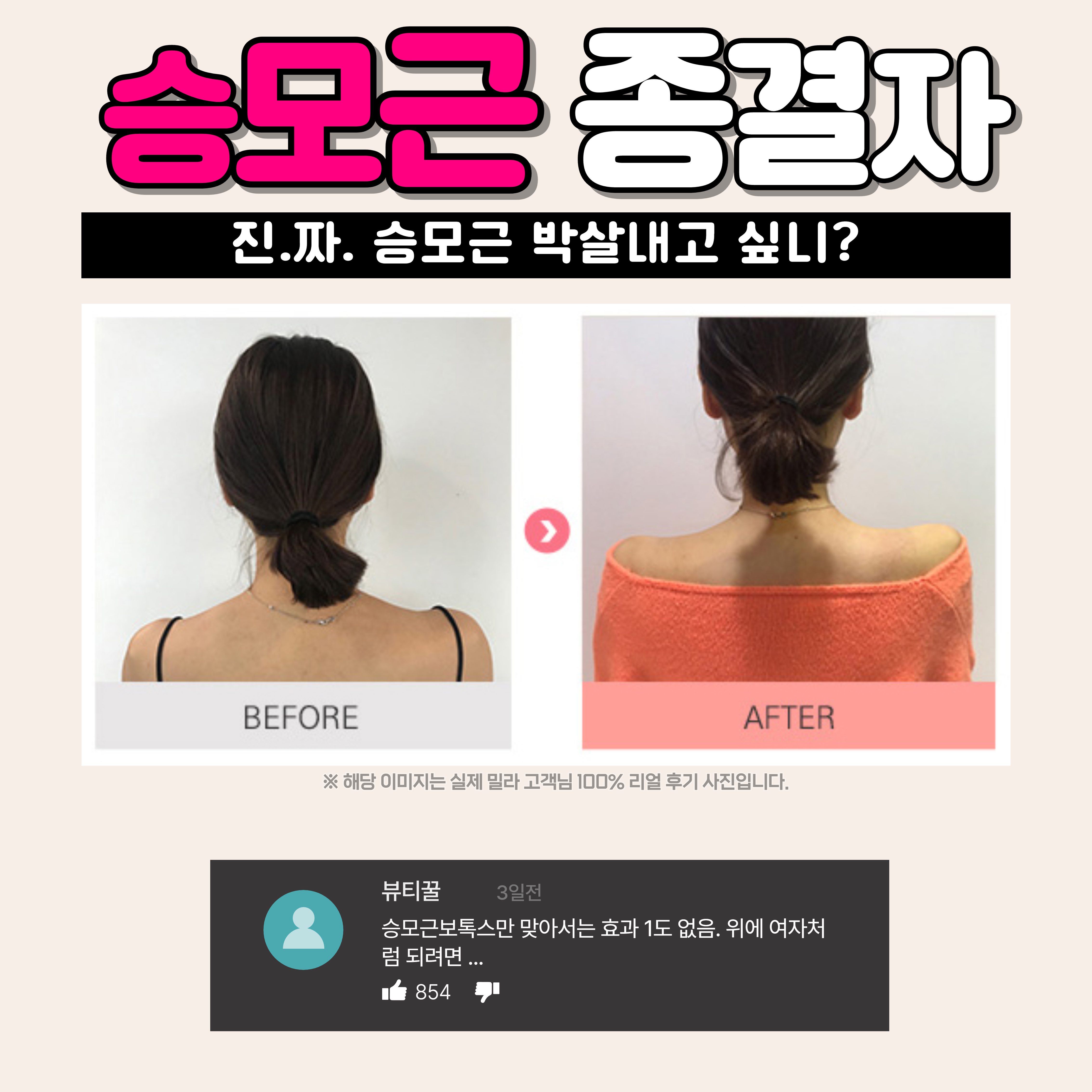 밀라의원 대표 이미지
