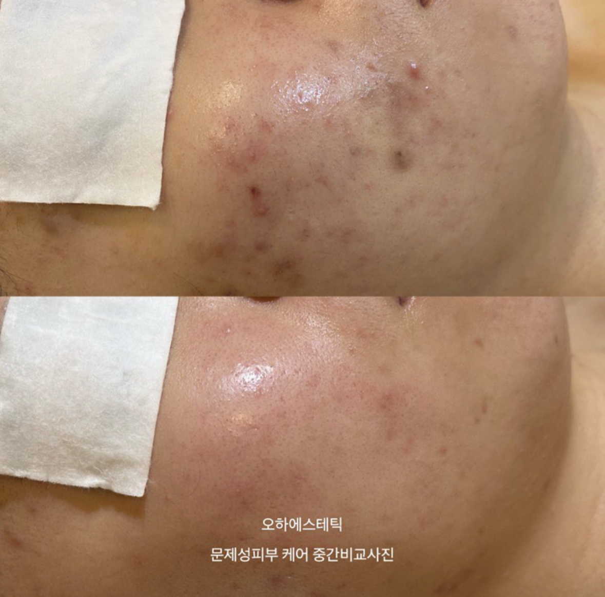 오하에스테틱 대구본점