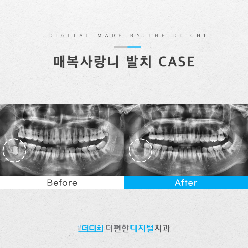 더편한디지털치과의원