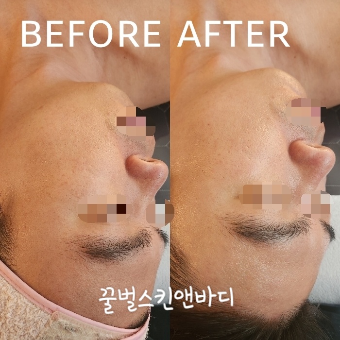 꿀벌스킨앤바디 대표 이미지