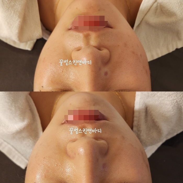 꿀벌스킨앤바디 대표 이미지