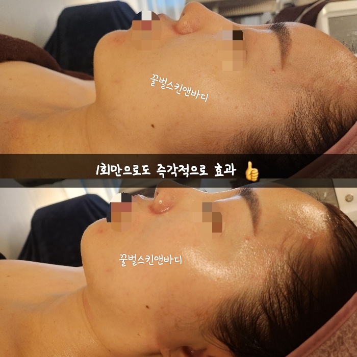 꿀벌스킨앤바디 대표 이미지