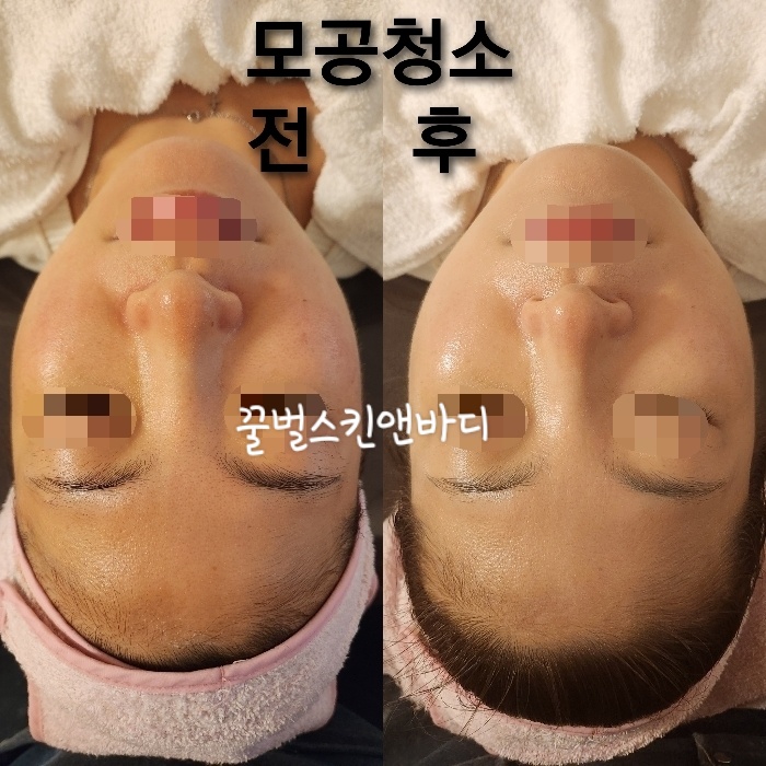 꿀벌스킨앤바디 대표 이미지