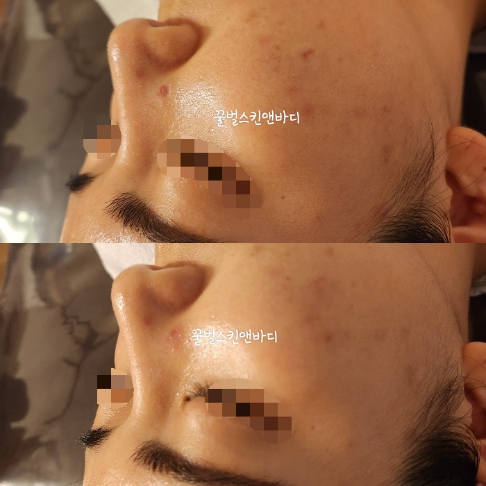 꿀벌스킨앤바디 대표 이미지