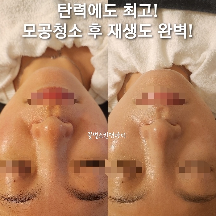 꿀벌스킨앤바디 대표 이미지