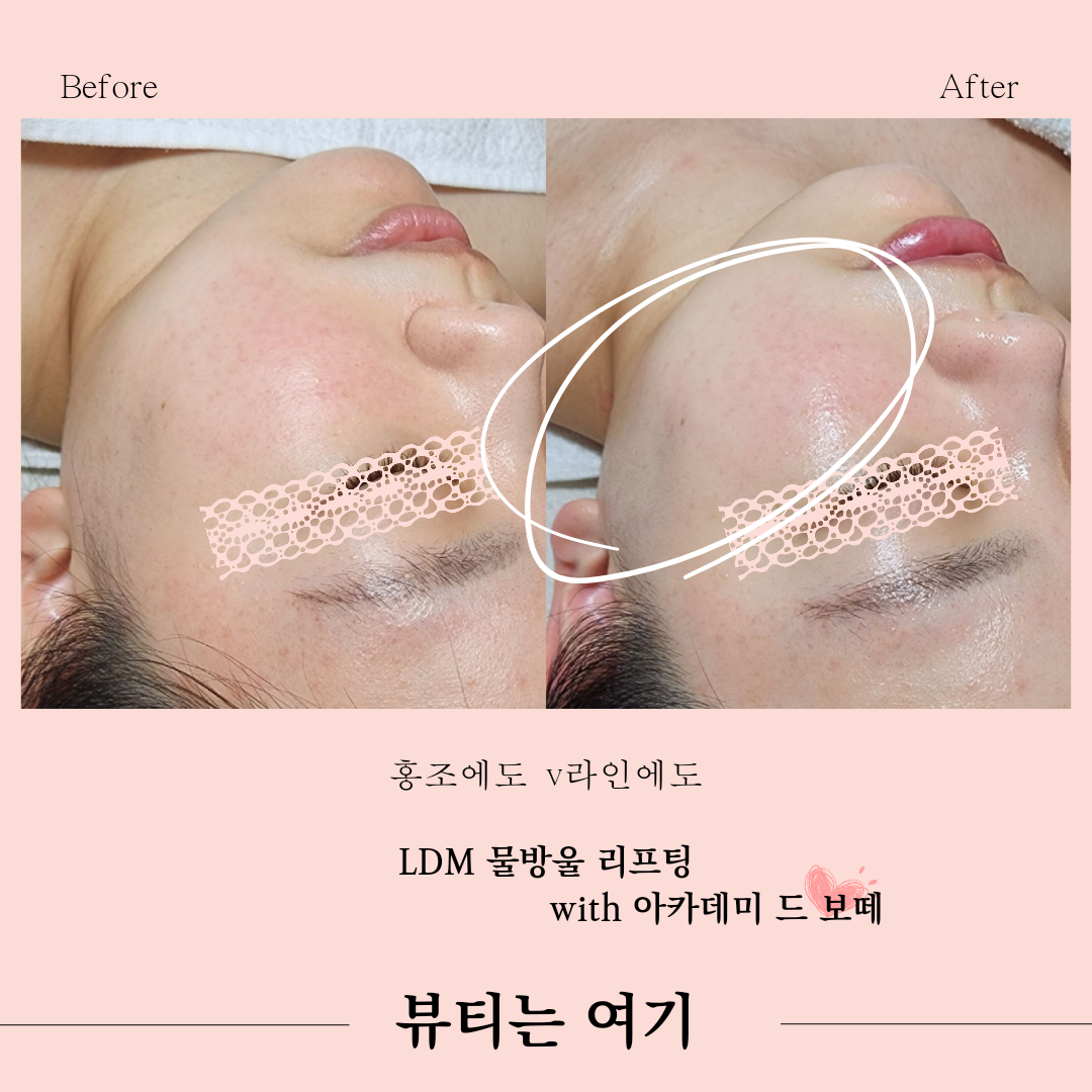 뷰티는여기 photo 10