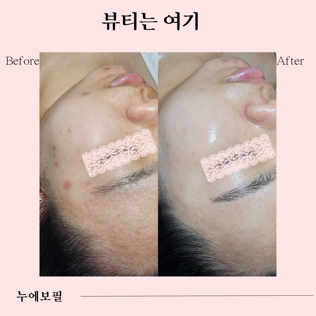 뷰티는여기 photo 4