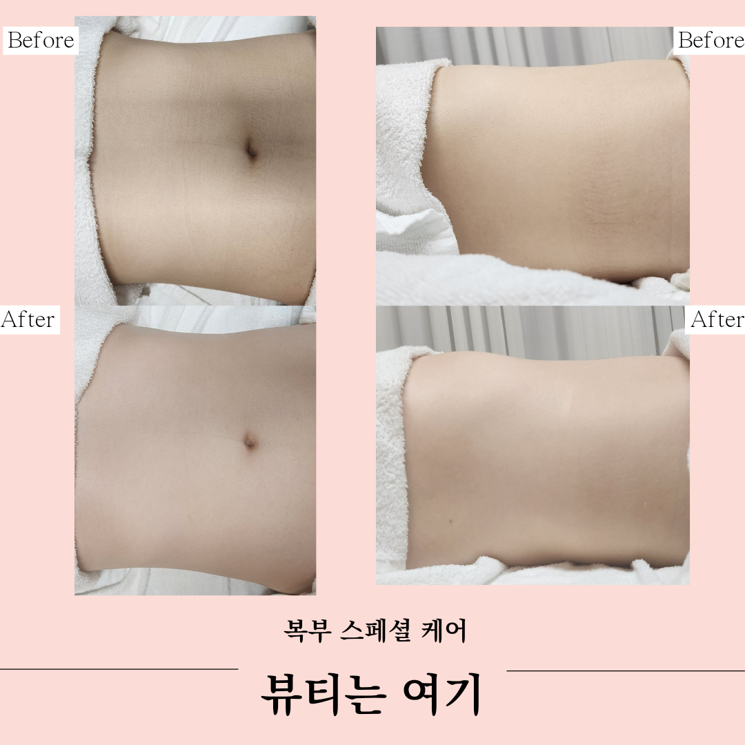 뷰티는여기 photo 5