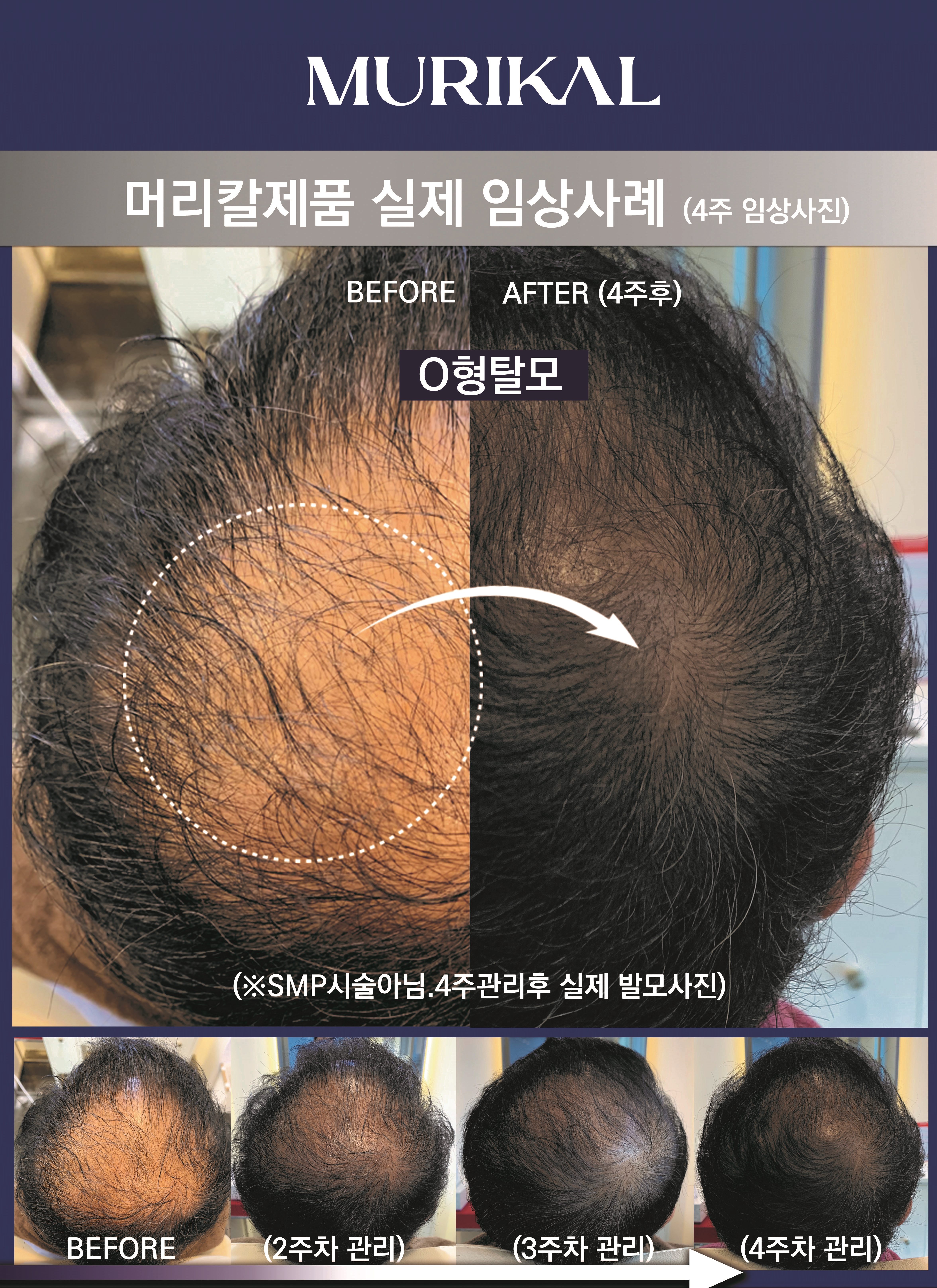 머리칼두피탈모 연경점 대표 이미지