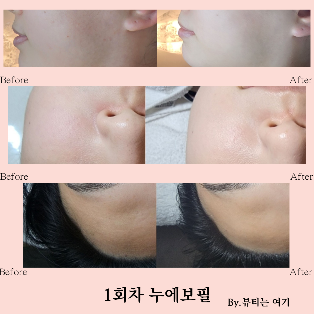 뷰티는여기 photo 6