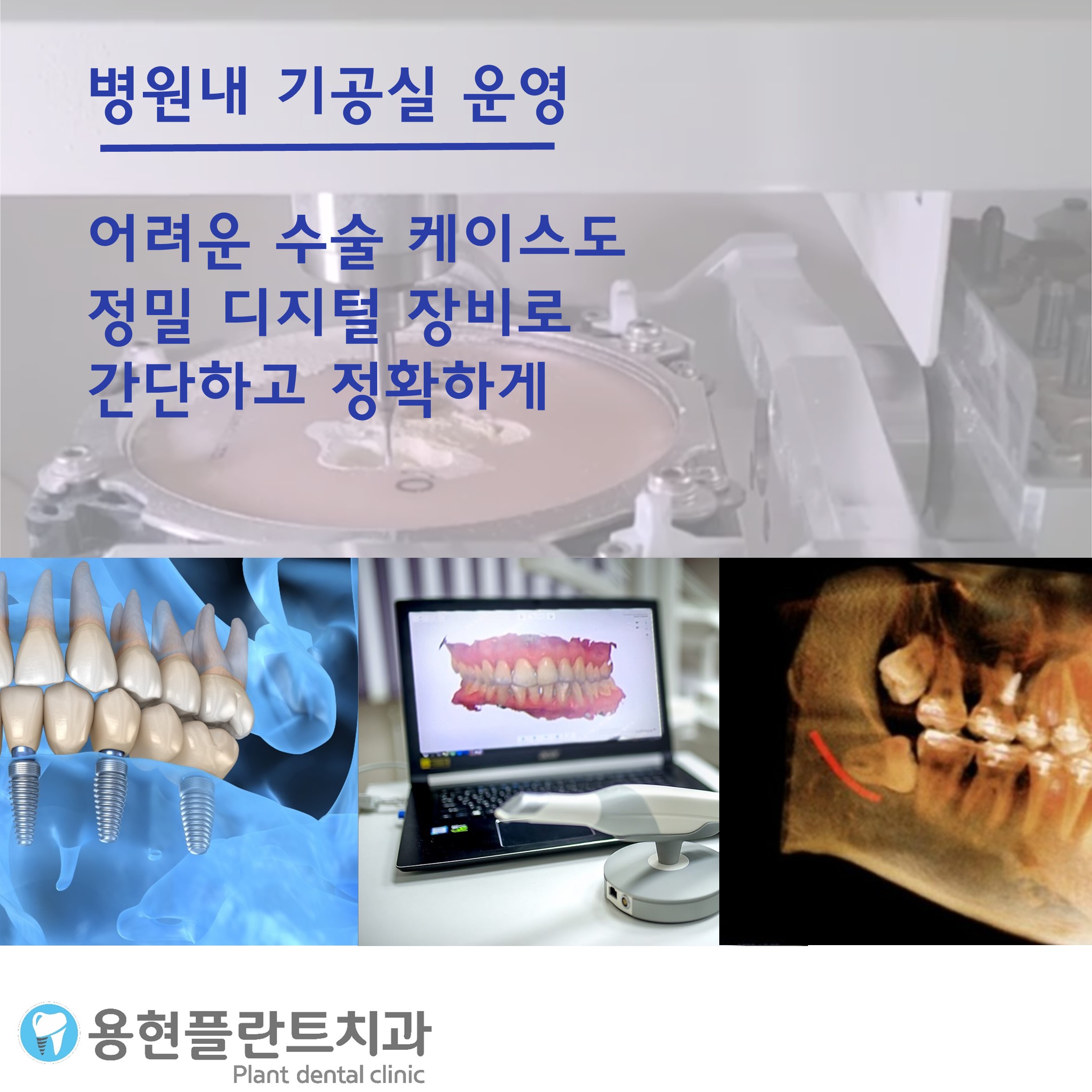 플란트구강악안면외과치과의원 대표 이미지