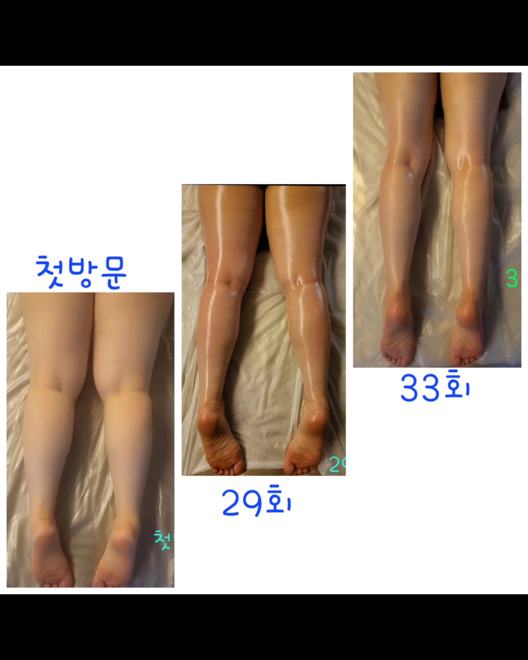 에너지테라피 포유 photo 3