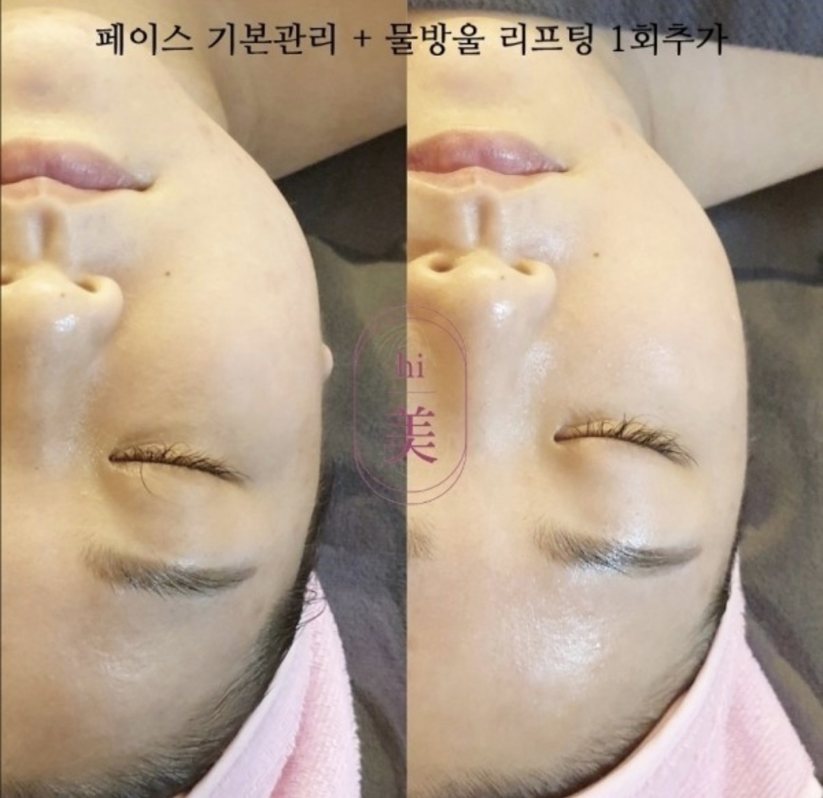 하이미 대표 이미지