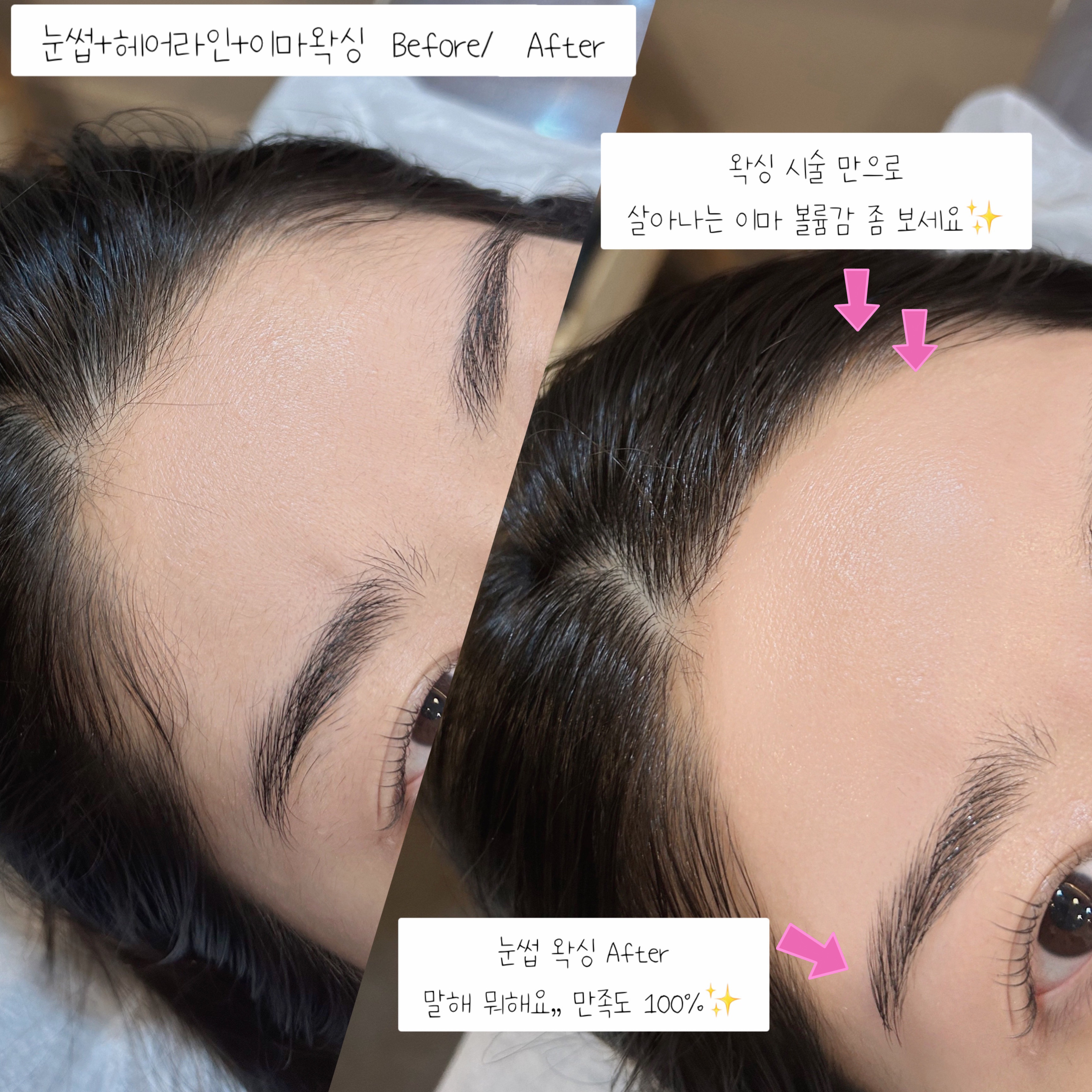 뷰티바잉
