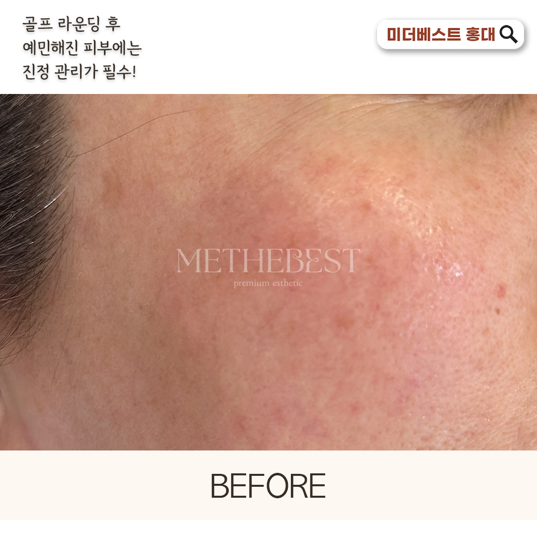 미더베스트 홍대점 대표 이미지